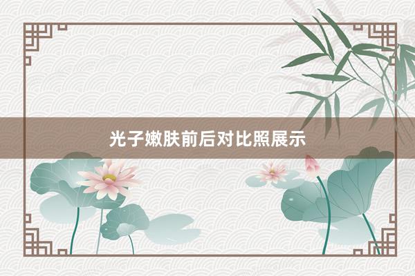 光子嫩肤前后对比照展示